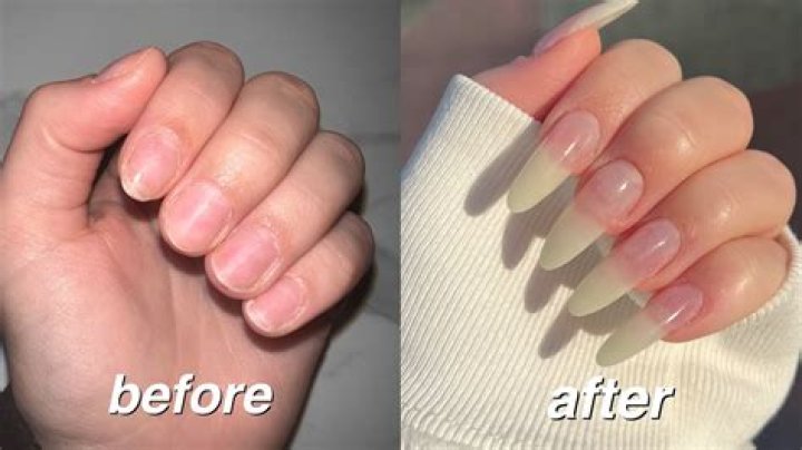 Are Long nails unsanitary?