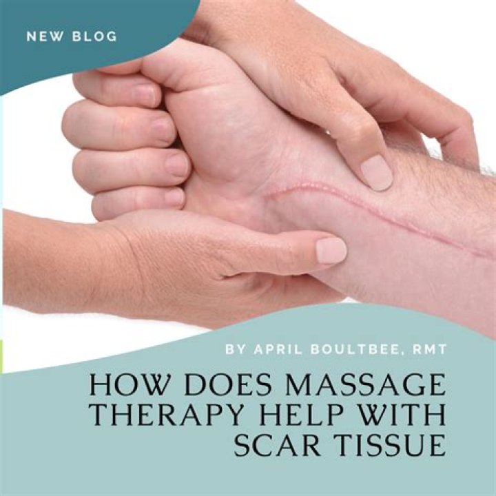 Are you supposed to massage scar tissue?