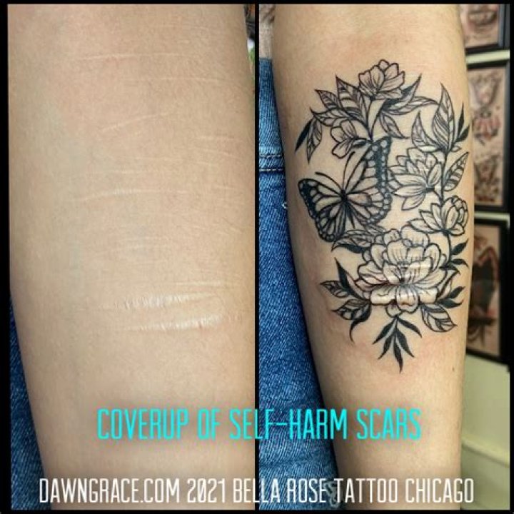 Can a tattoo scar?