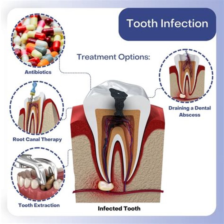 Can a tooth infection make you feel unwell?