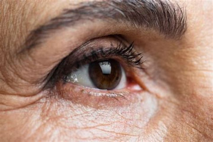 Can brown eyes turn GREY?