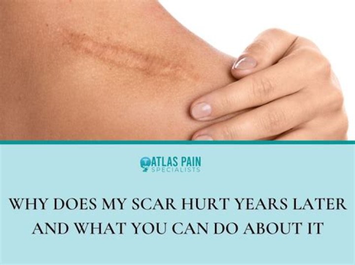 Can C-section scar hurt years later?