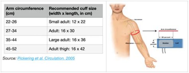 Can cuff size affect blood pressure?