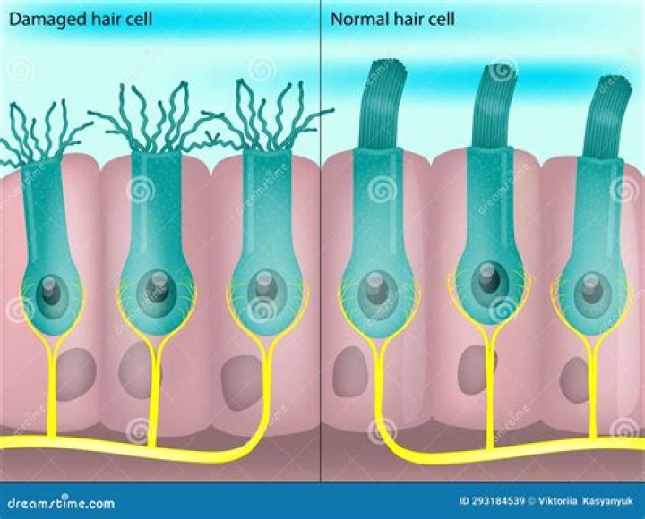 Can damaged hair cells be repaired?