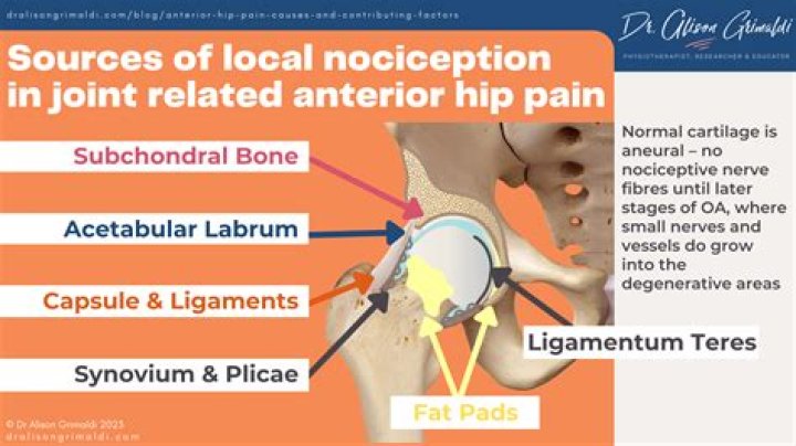 Can fibromyalgia cause severe hip pain?