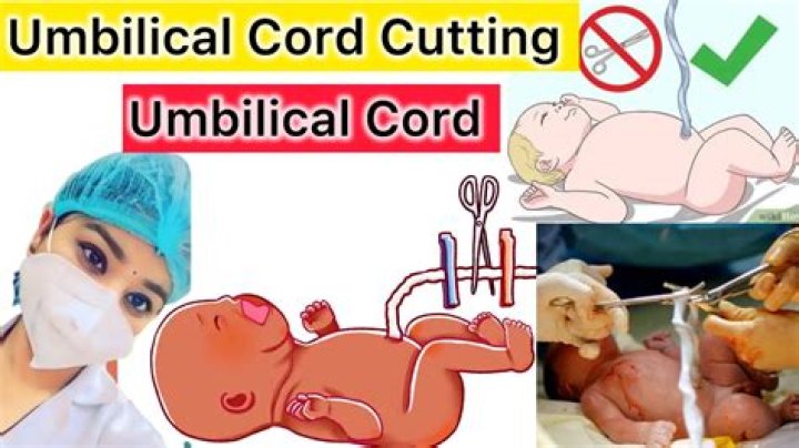 Can I cut my own umbilical cord?