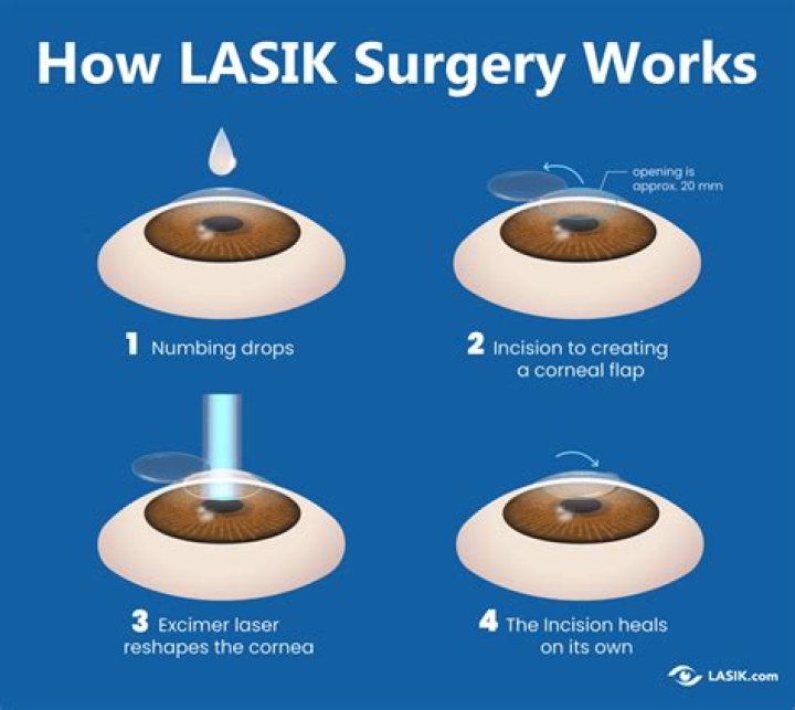 Can I look at screens after LASIK?