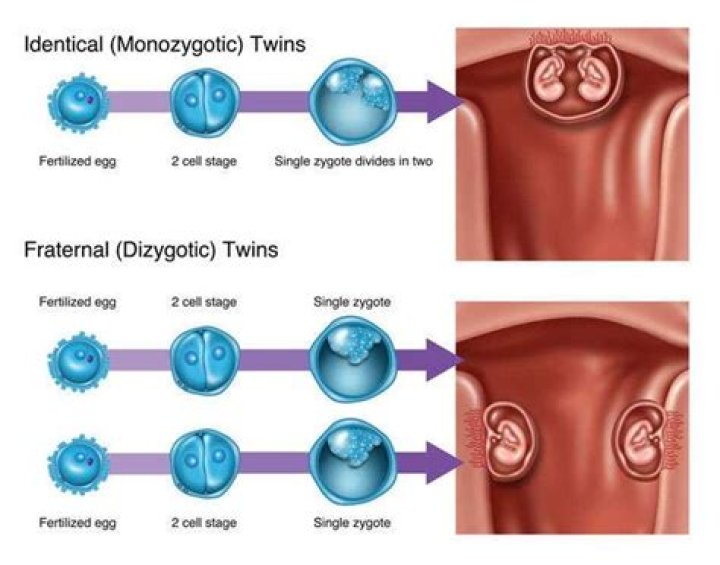 Can IVF cause identical twins?