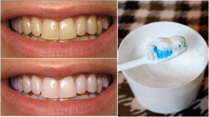 Can milk whiten teeth?