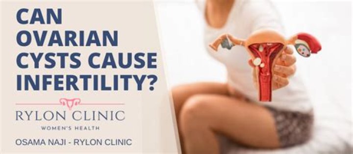 Can ovarian cysts cause anxiety?