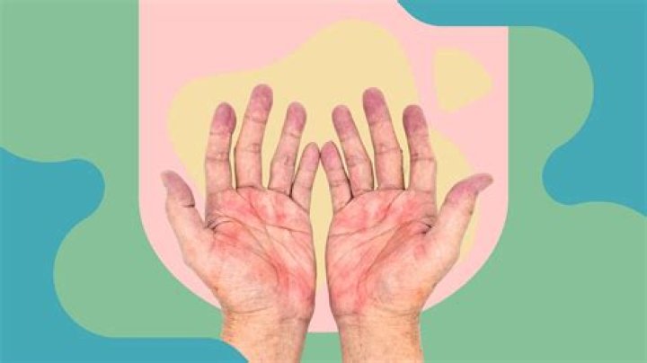 Can red wine help rheumatoid arthritis?