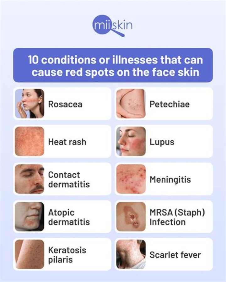 Can retinol cause dark spots?