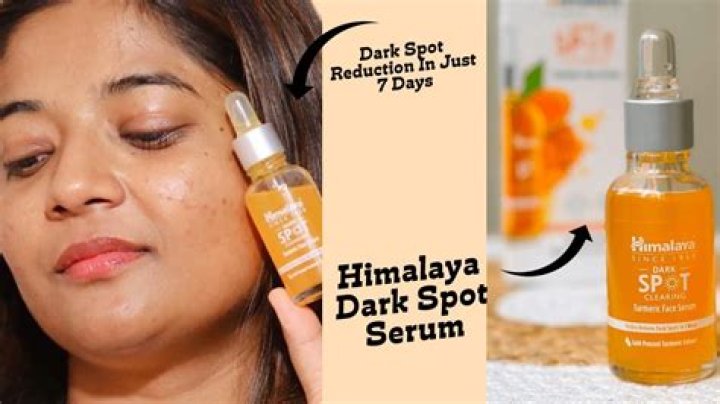 Can serum remove dark spots?