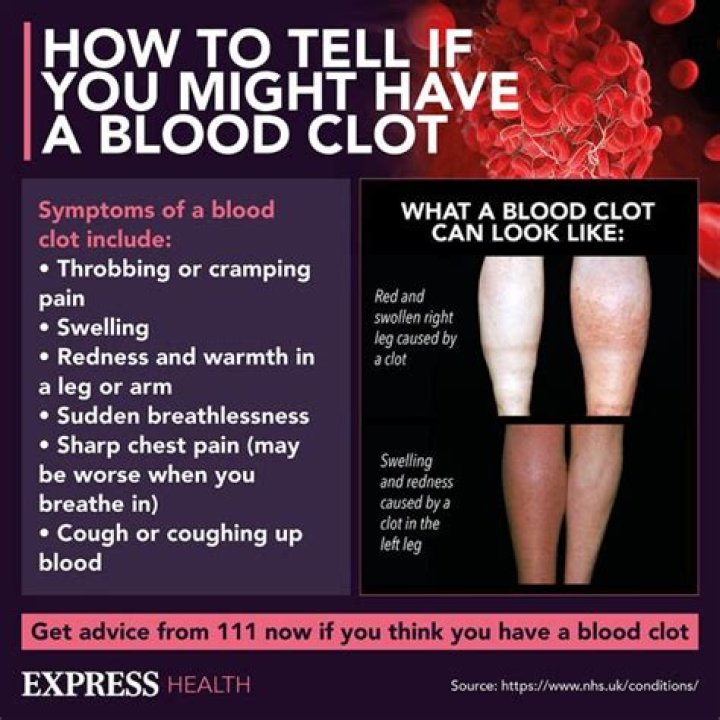 Can sitting too much cause blood clots?