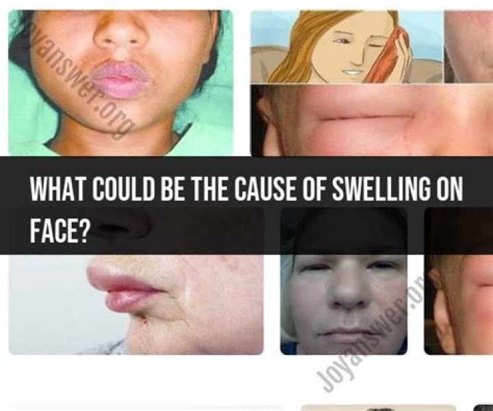 Can sleeping on your face cause swelling?