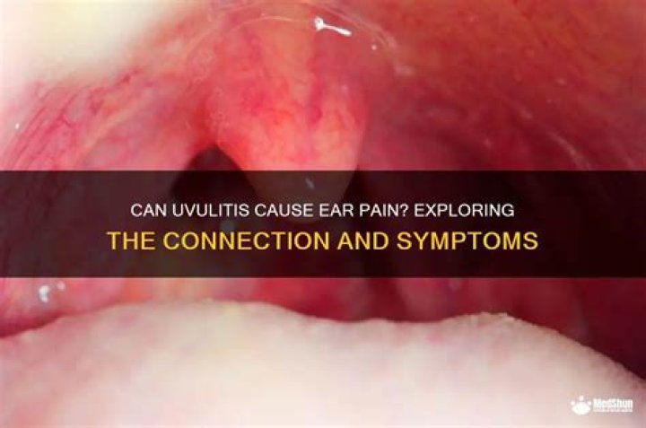 Can snoring cause uvulitis?