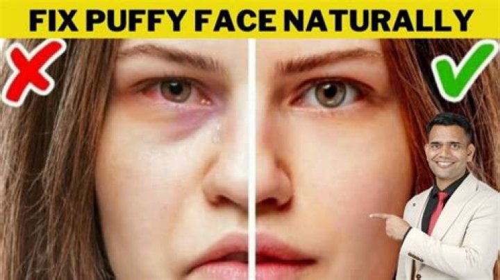Can wine make your face puffy?