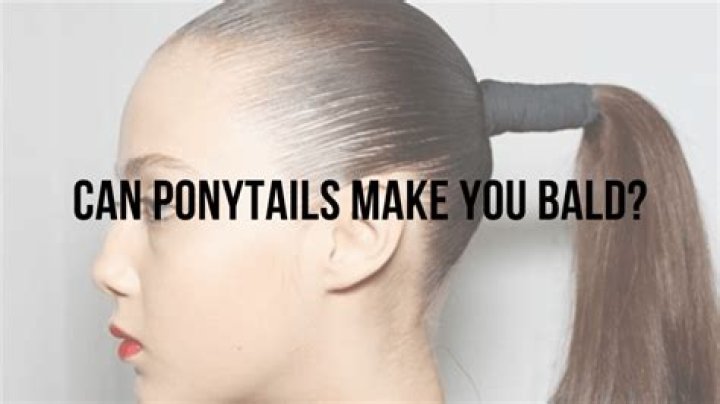 Can you bald at 16?