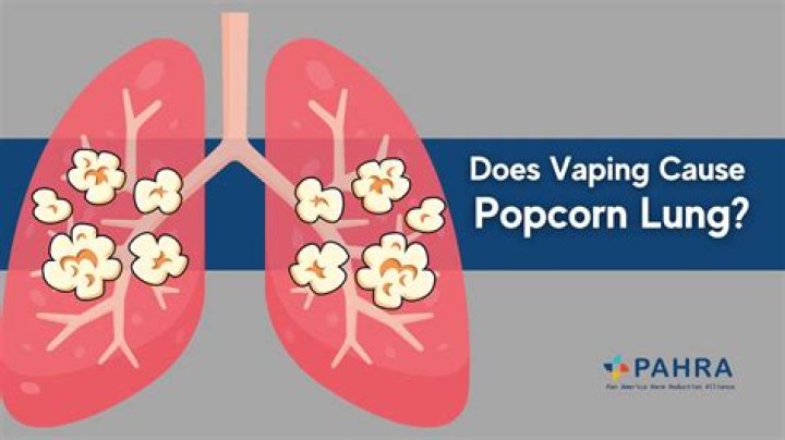 Can you get mold in your lungs from vaping?