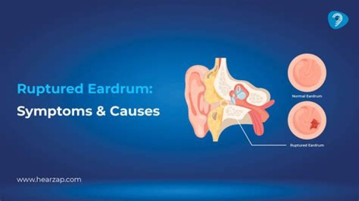Can you live with a perforated eardrum?