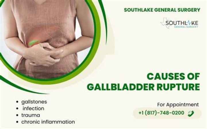 Can you live with a ruptured gallbladder?