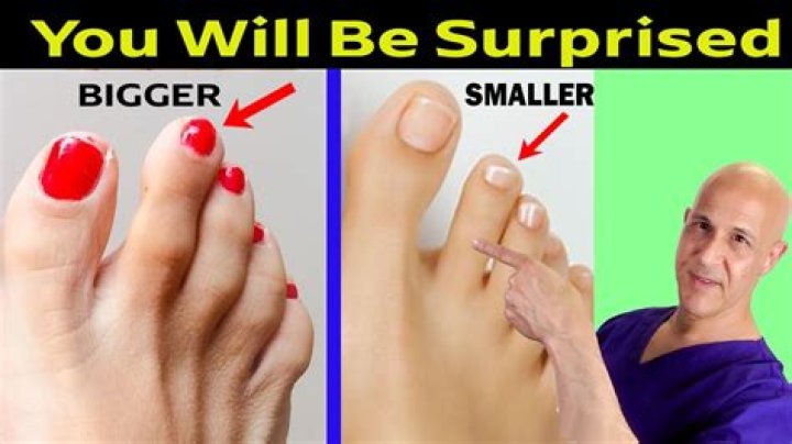 Can you make big toe smaller?