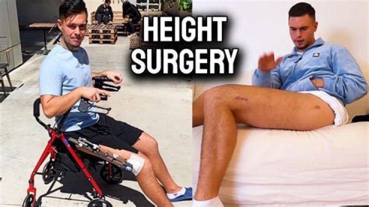 Can you walk after leg-lengthening surgery?