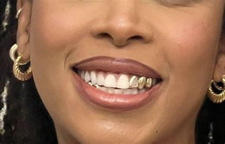 Can you wear gold teeth to work?