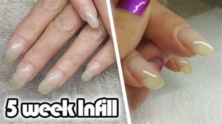Do acrylic nails hurt to take off?