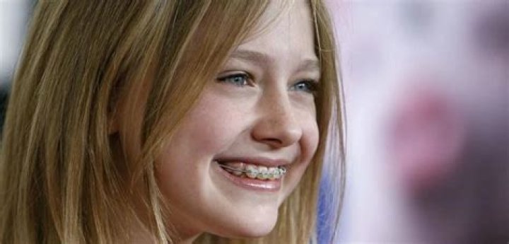 Do celebrities get braces?