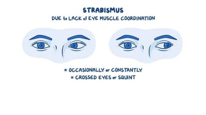 Do contacts help strabismus?