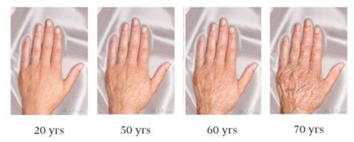 Do hands get bigger with age?