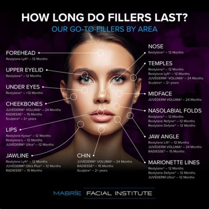 Do lip fillers change your face?