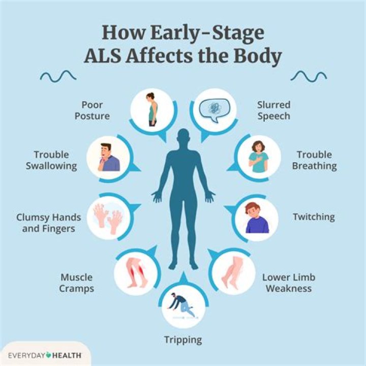 Do people with ALS suffer pain?