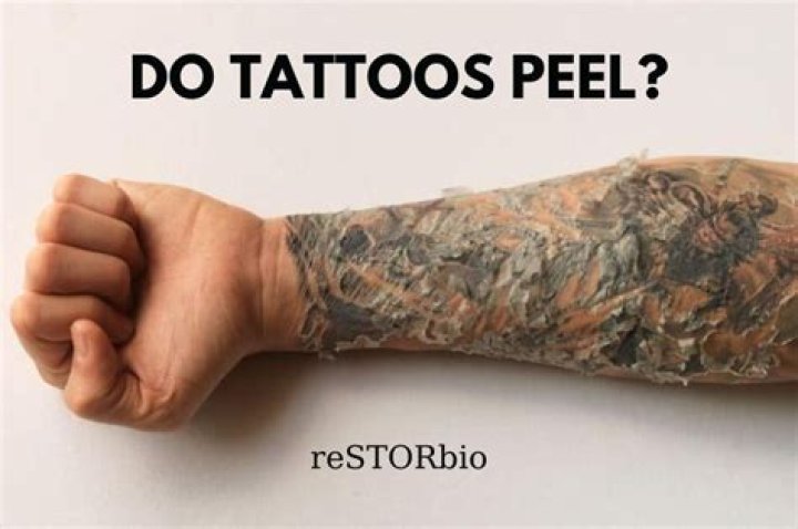 Do tattoos peel?
