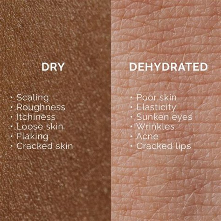Do wrinkles show more when dehydrated?