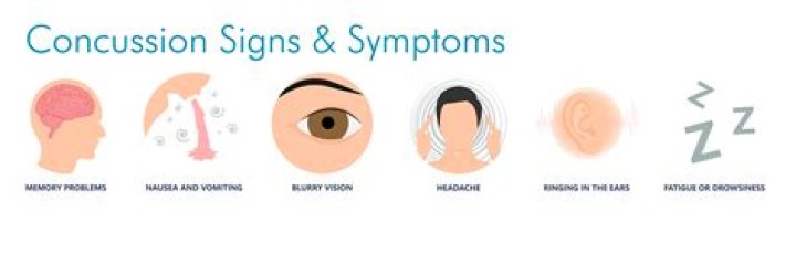 Do you feel concussion symptoms immediately?