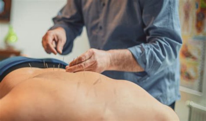 Does an acupuncture hurt?
