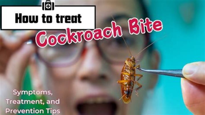 Does cockroach bite hair?
