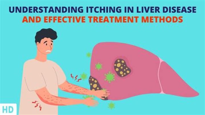 Does itching mean liver problems?