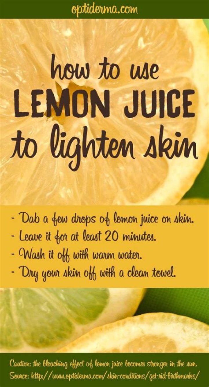 Does lemon juice remove freckles?