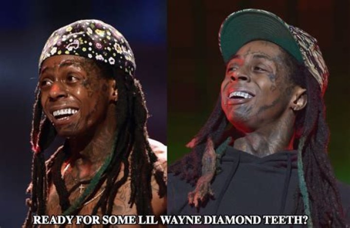 Does Lil Wayne have diamond teeth?