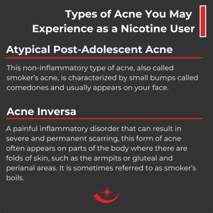 Does nicotine cause acne?