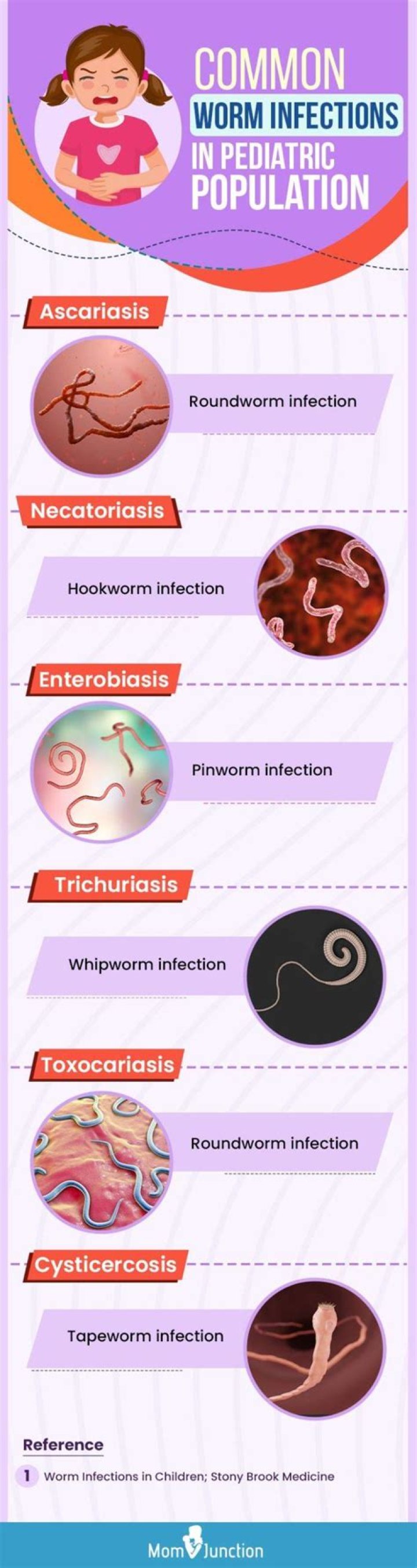 Does pinworm itch during the day?