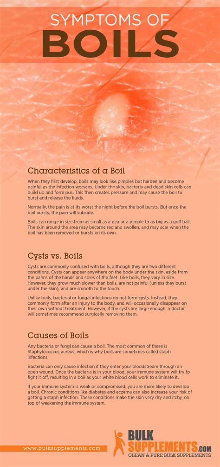 Does pus come out of a boil?