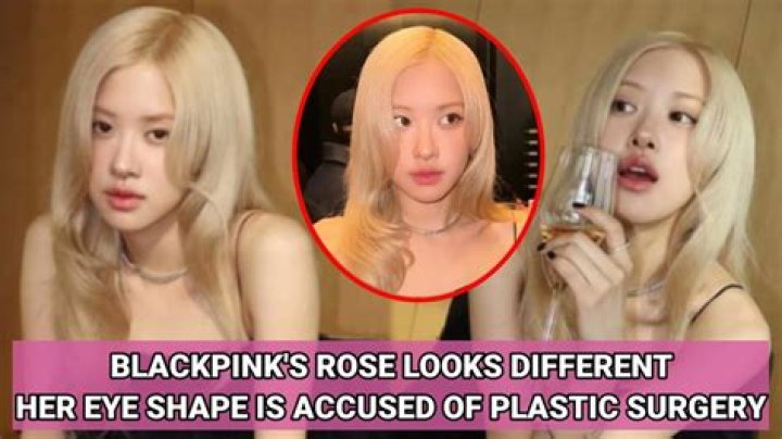 Does Rose have plastic surgery?