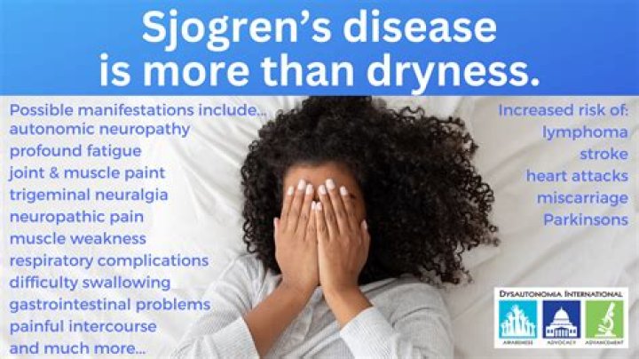 Does Sjogren's shorten your lifespan?