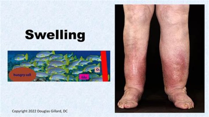 Does swelling indicate a break?