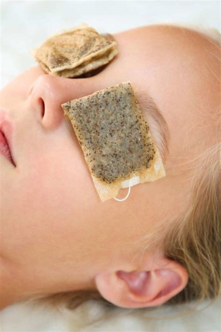 Does tea bags on eyes work?
