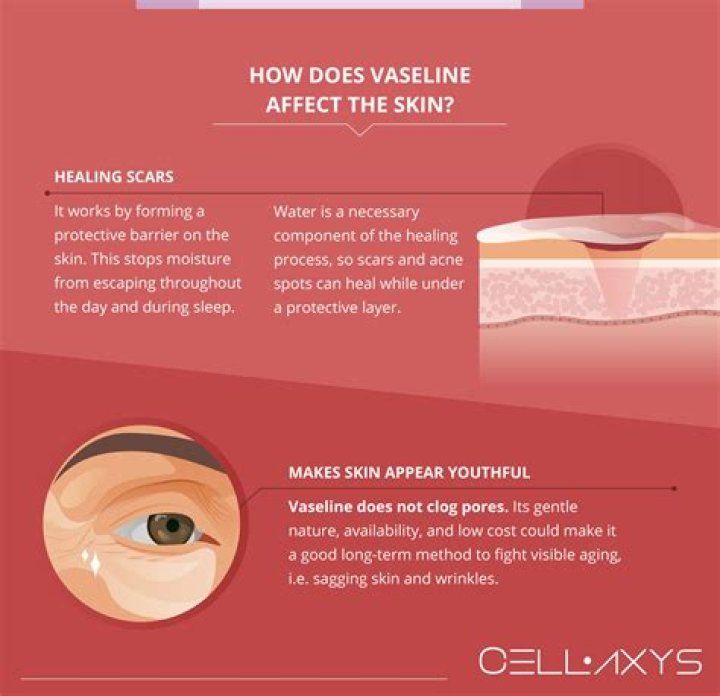 Does Vaseline help tighten skin?